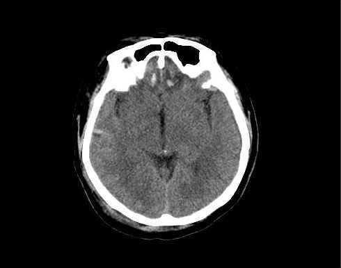 MRI-CT-head.jpg