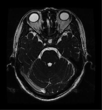 MRI-head.jpg